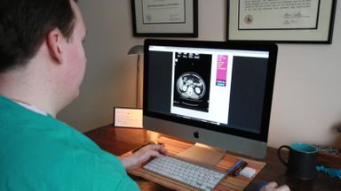 New doctor looking at a patients scan after changing careers